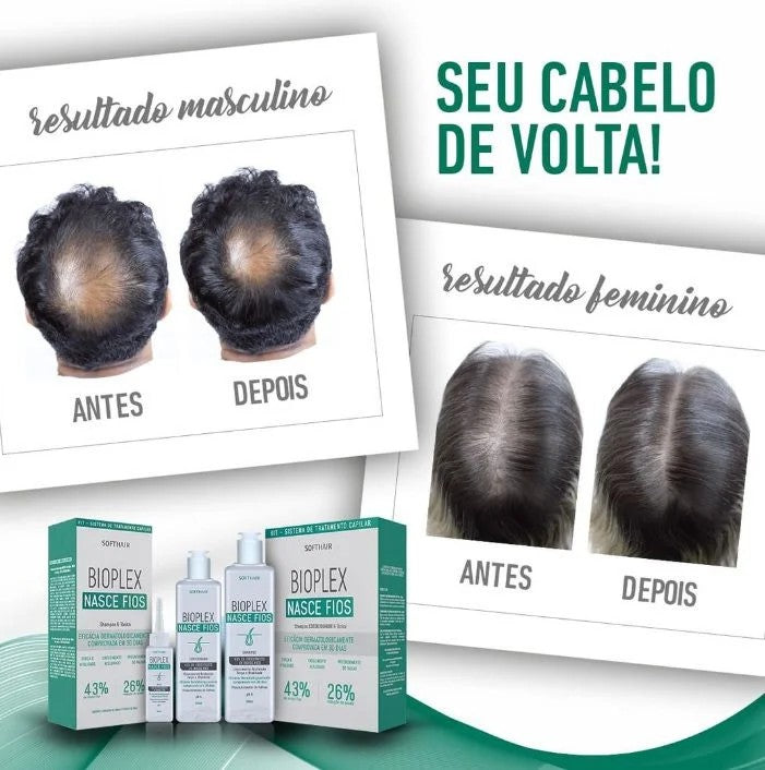 Tônico Capilar Anti Queda E Calvície Bioplex Nasce Fios 60ml - Shopmano